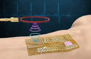 Инженеры Массачусетского технологического института создают беспроводную электронную кожу без чипов